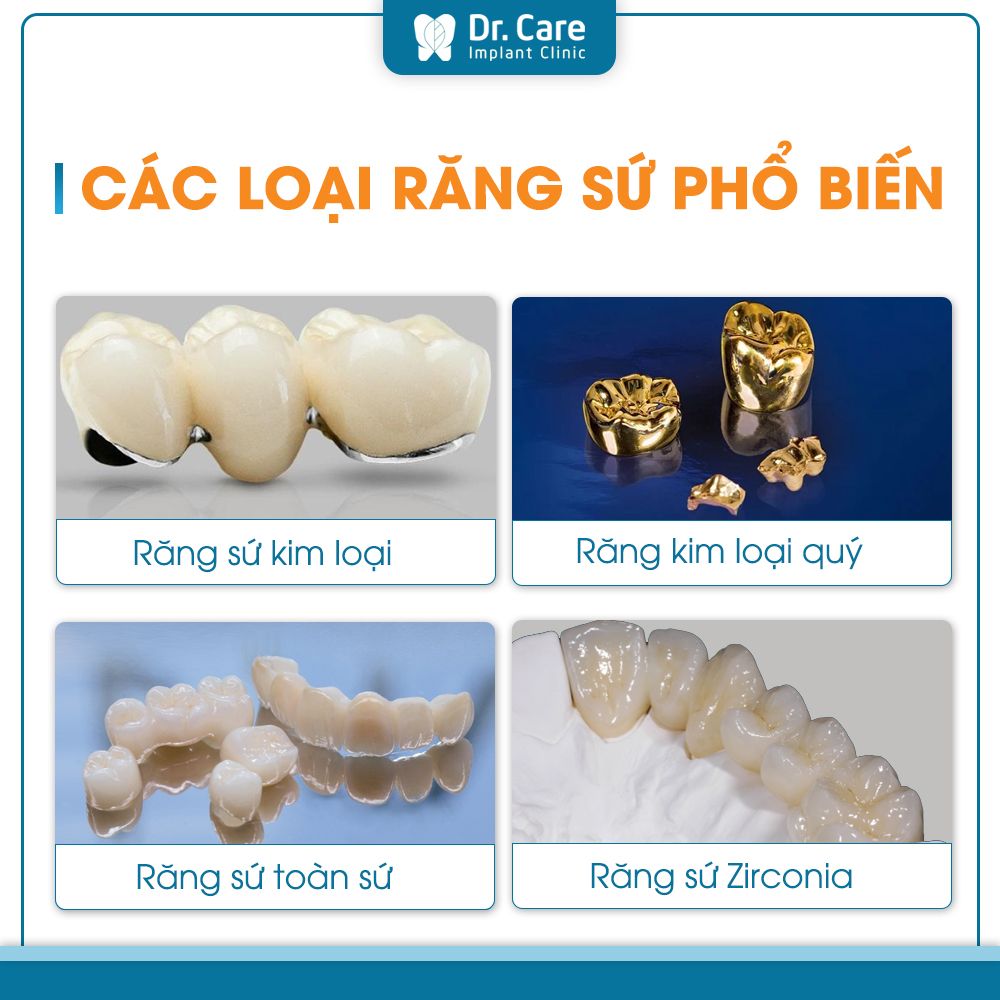 Nên lựa chọn bọc răng sứ 1 chiếc loại nào? 