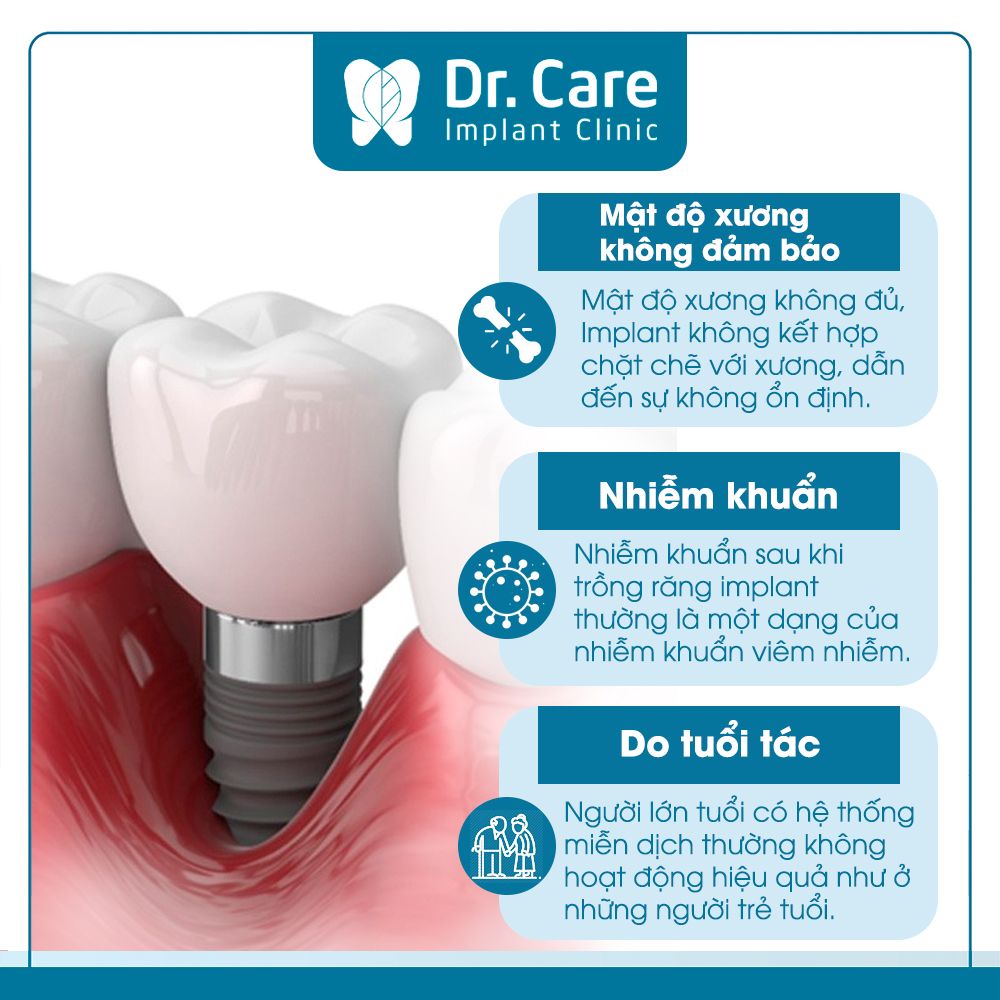 Nguyên nhân Implant bị đào thải