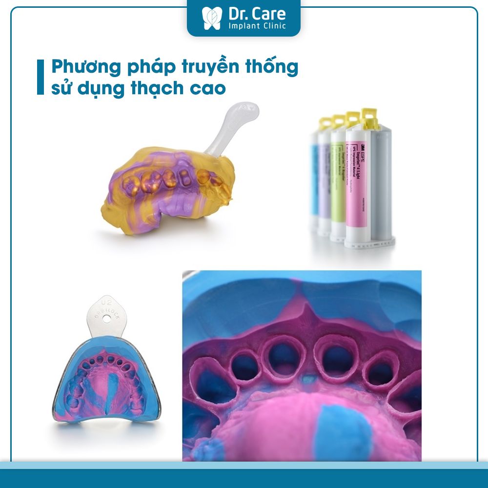 Các phương pháp lấy dấu răng trên Implant