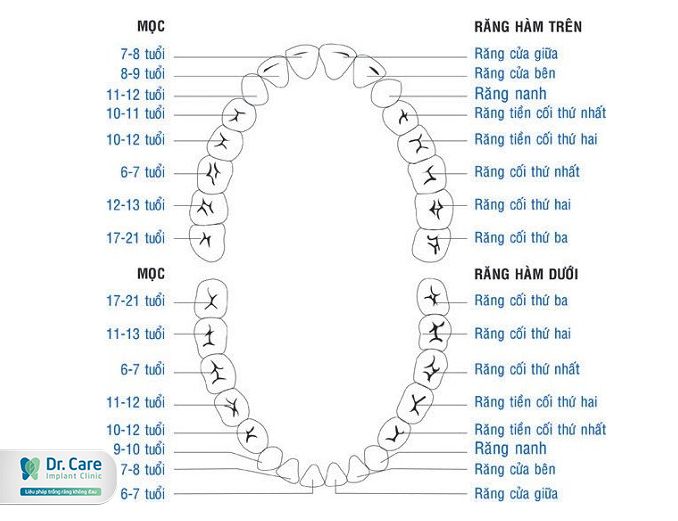 Răng cấm là gì? Trồng răng cấm bao nhiêu tiền