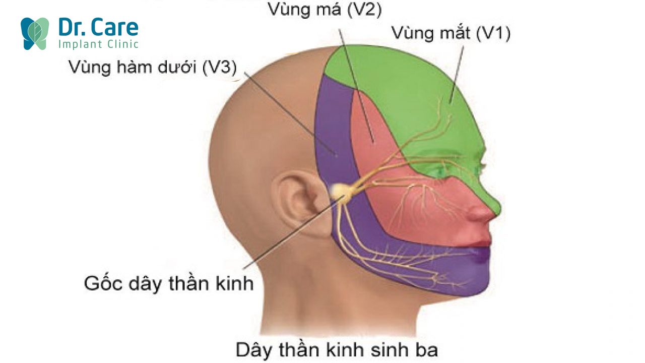 Đau dây thần kinh sinh ba