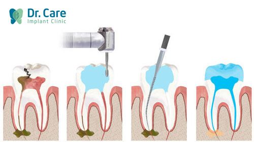 Điều trị chuyên sâu