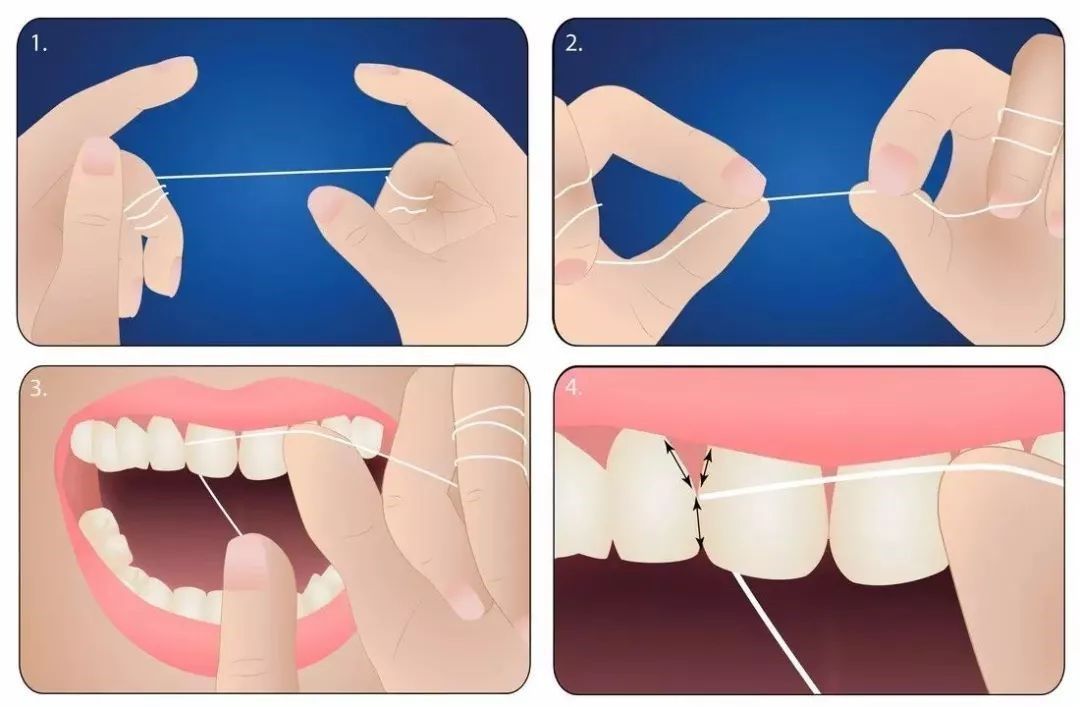 ​Cách chải răng đúng cách