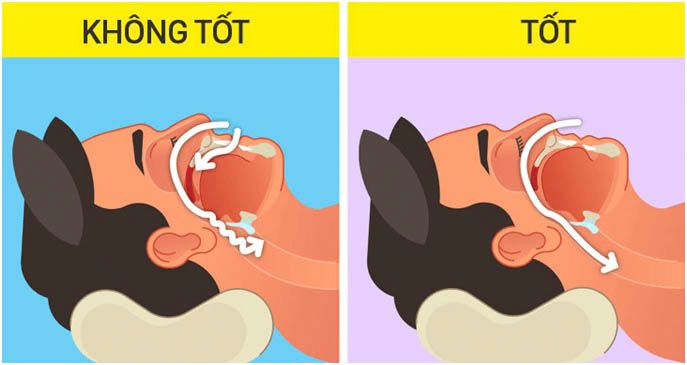 Những điều cần lưu ý khi tập Mewing