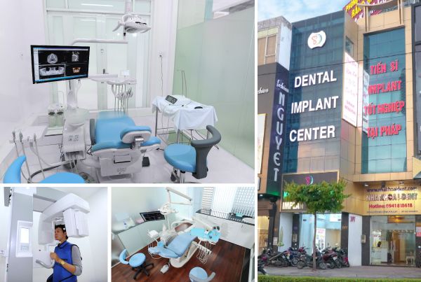 Nha khoa I-Dent - Nha khoa cắm Implant tốt