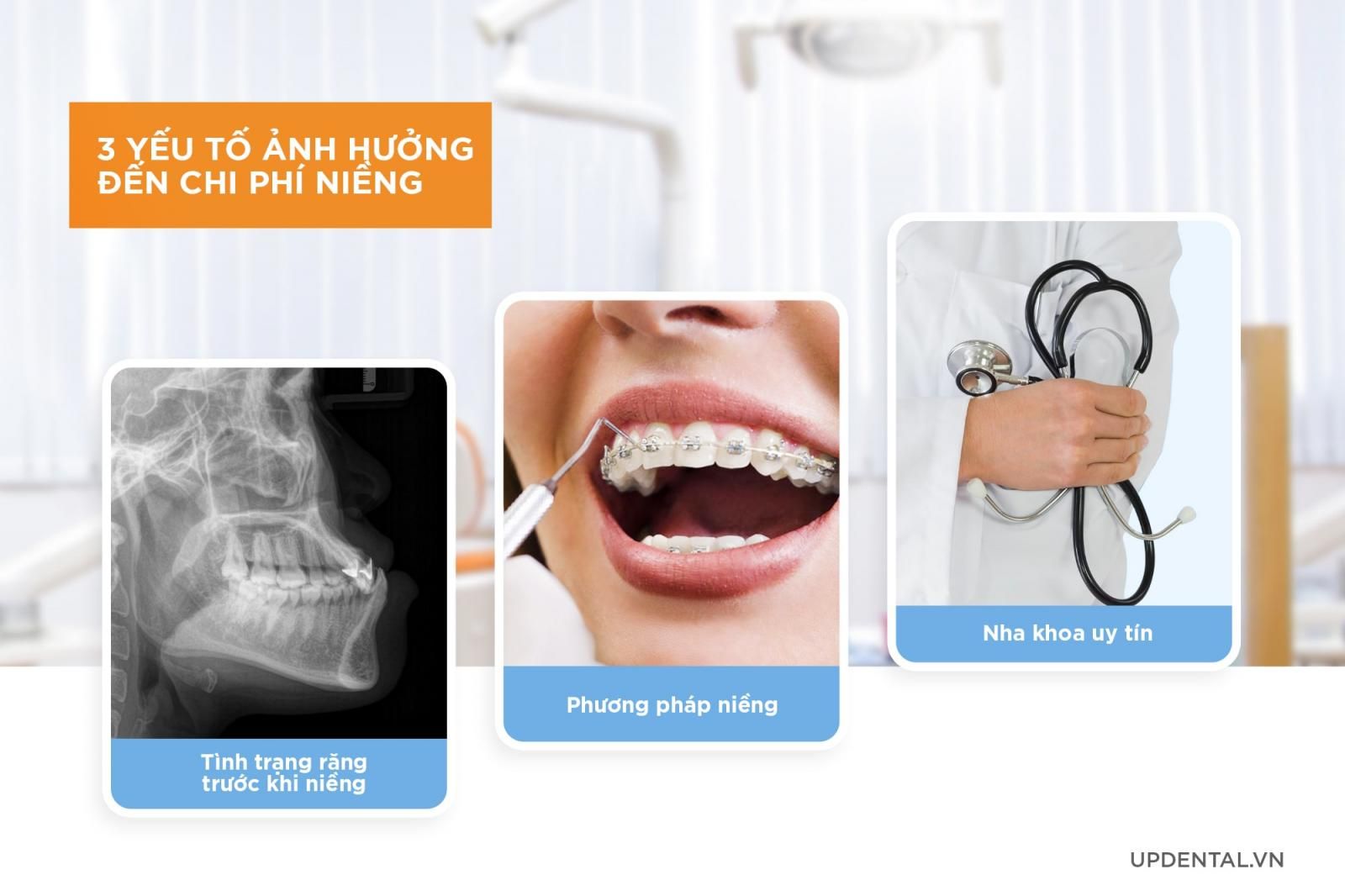 3 yếu tố ảnh hưởng đến chi phí niềng răng