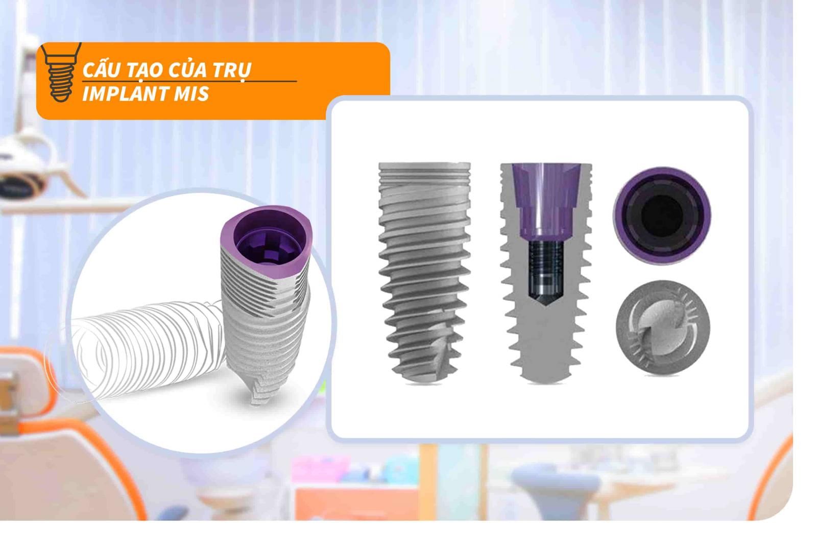 Cấu tạo của trụ Implant MIS