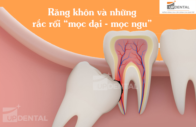 rang khon moc dai la sao