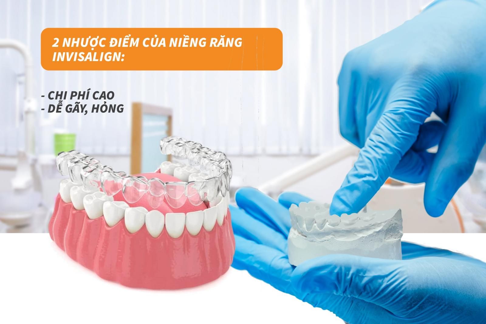 2 nhược điểm của niềng răng Invisalign