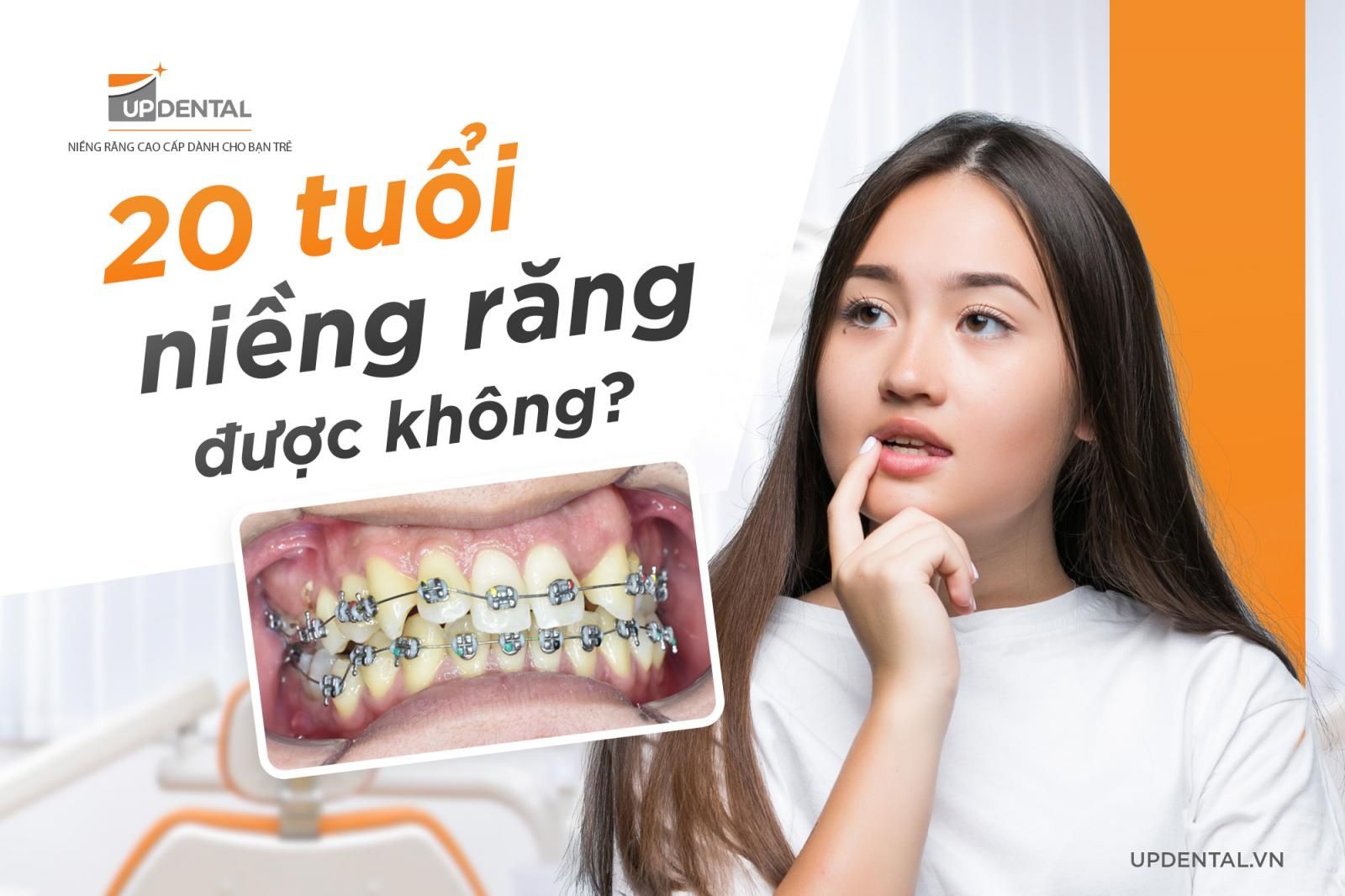 Những Lưu Ý Khi Niềng Răng Ở Tuổi Trưởng Thành