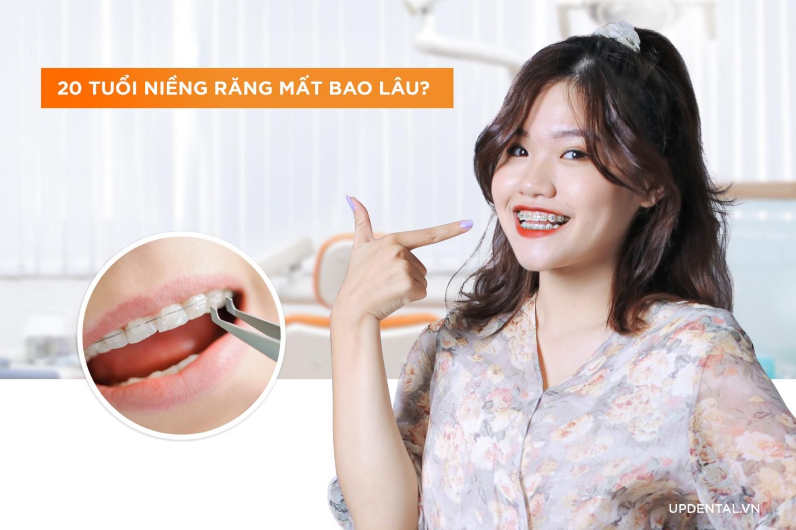 20 tuổi niềng răng mất bao lâu