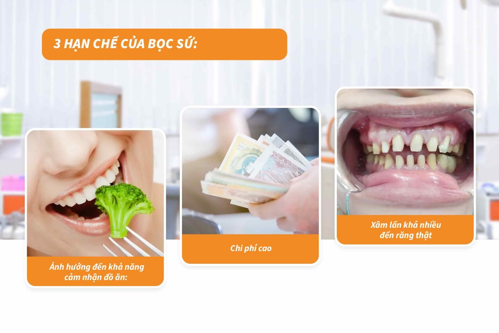 03 hạn chế của bọc sứ: