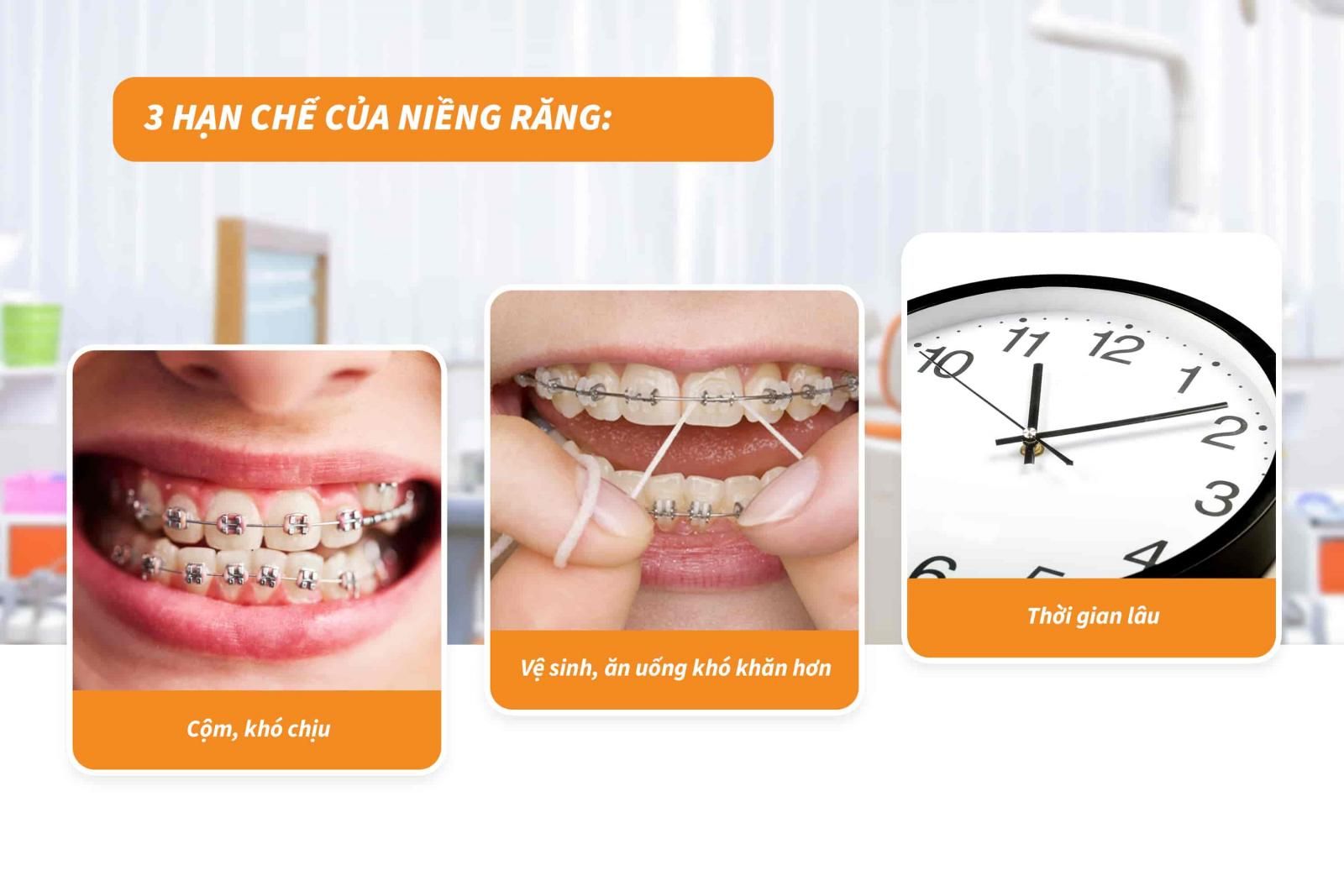 03 Hạn chế của niềng răng