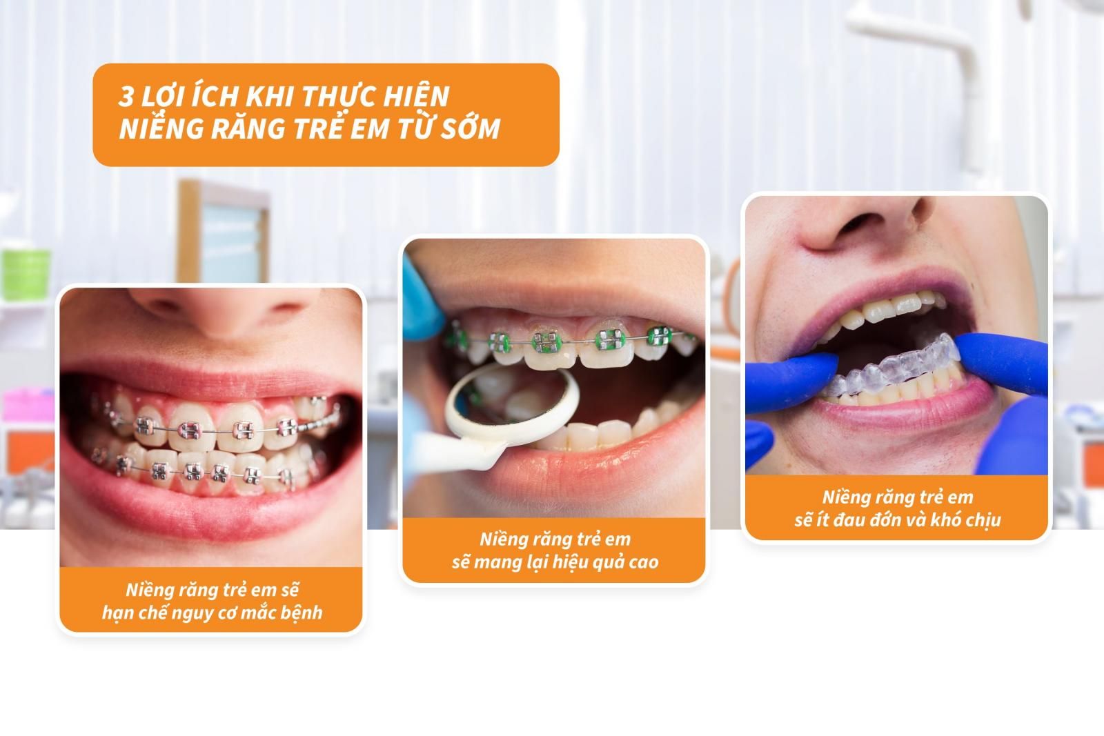 03 lợi ích khi thực hiện niềng răng trẻ em từ sớm