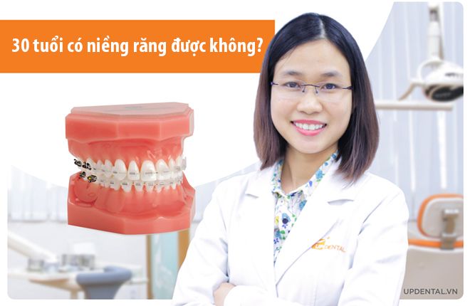 30 tuổi có niềng răng được không?