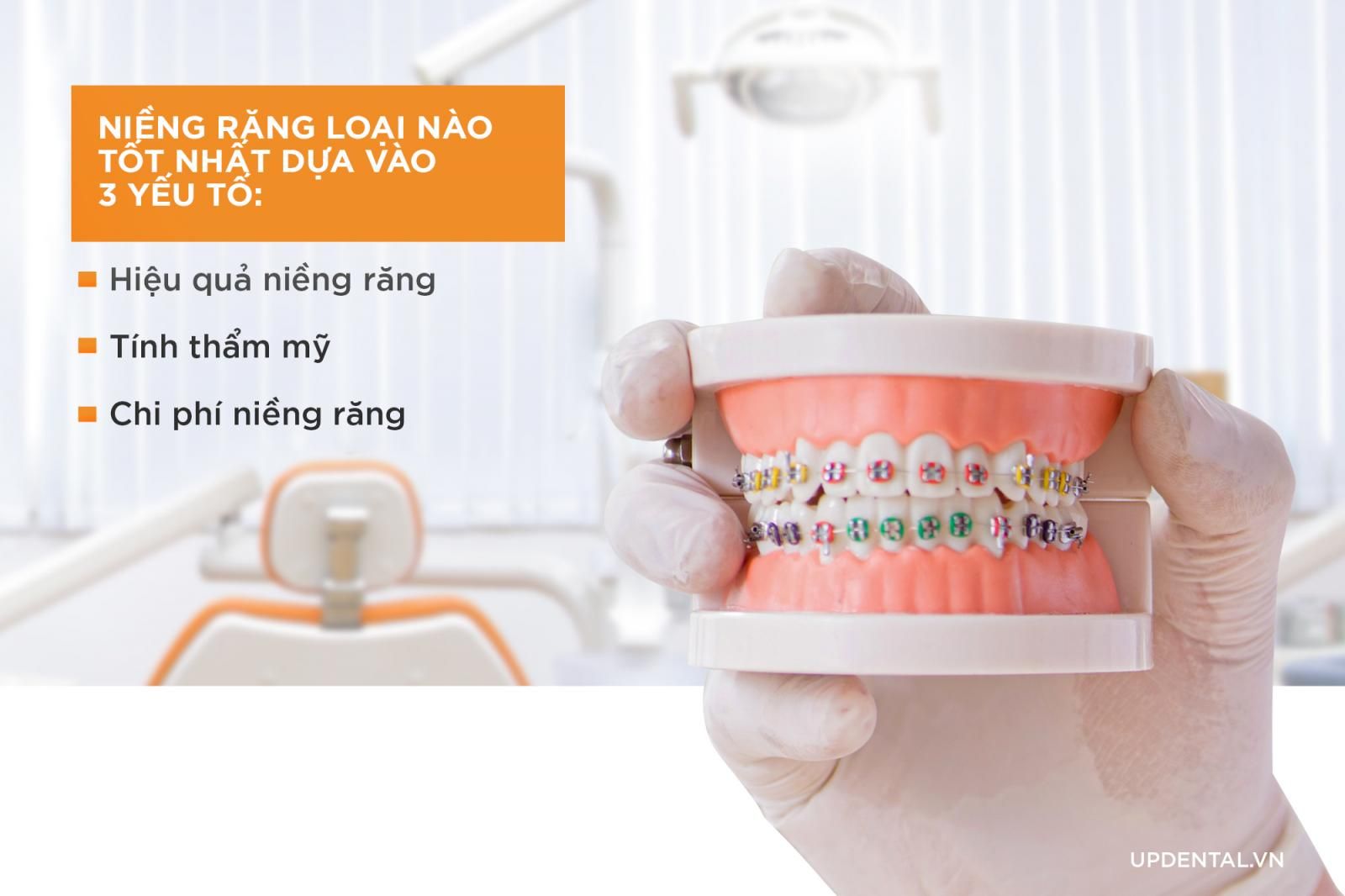 Niềng răng loại nào tốt nhất