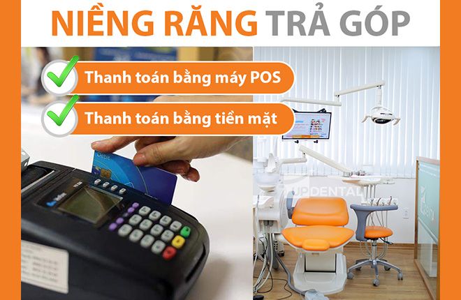 niềng răng giá rẻ với chính sách trả góp