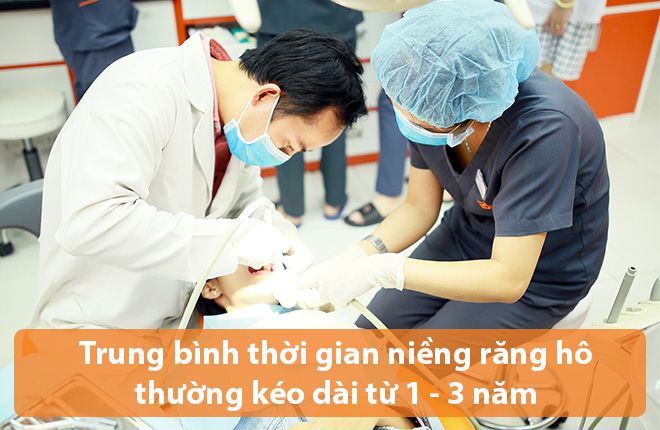 niềng răng hô mất bao lâu