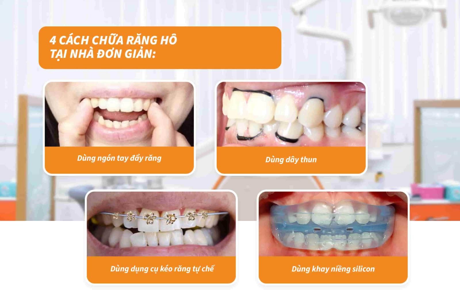 4 cách chữa răng hô tại nhà đơn giản