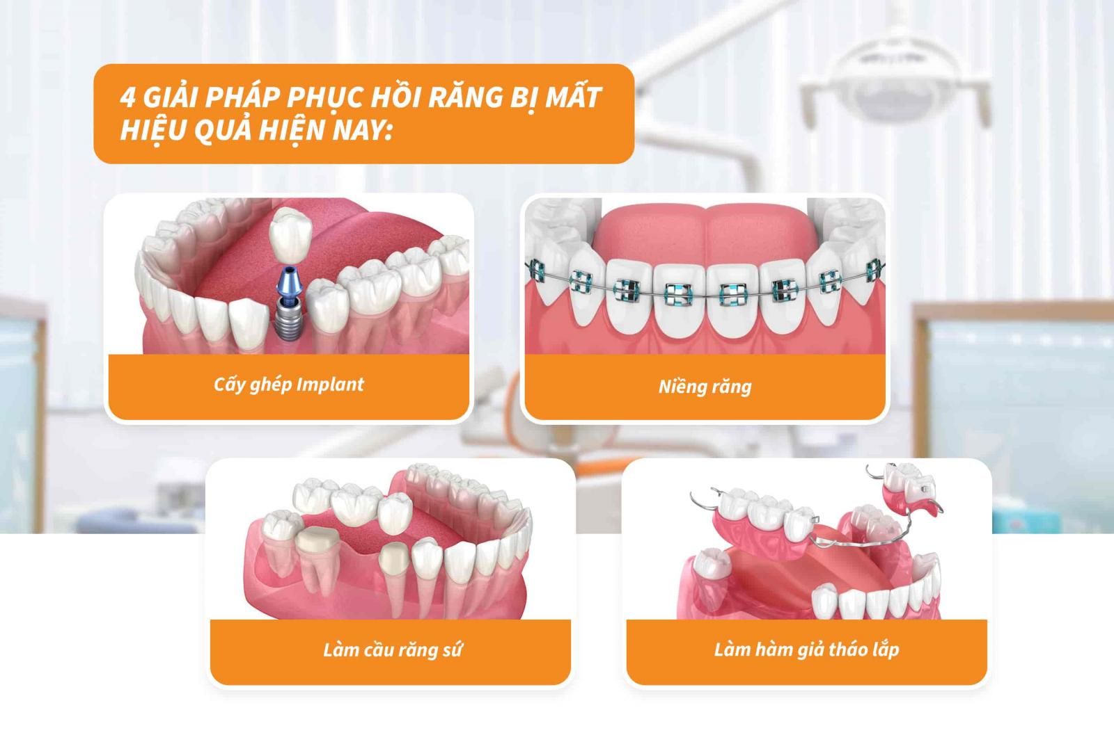 4 giải pháp phục hồi răng bị mất hiệu quả hiện nay