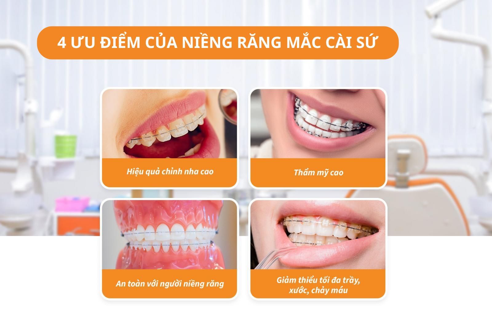 Ưu điểm của niềng răng mắc cài sứ