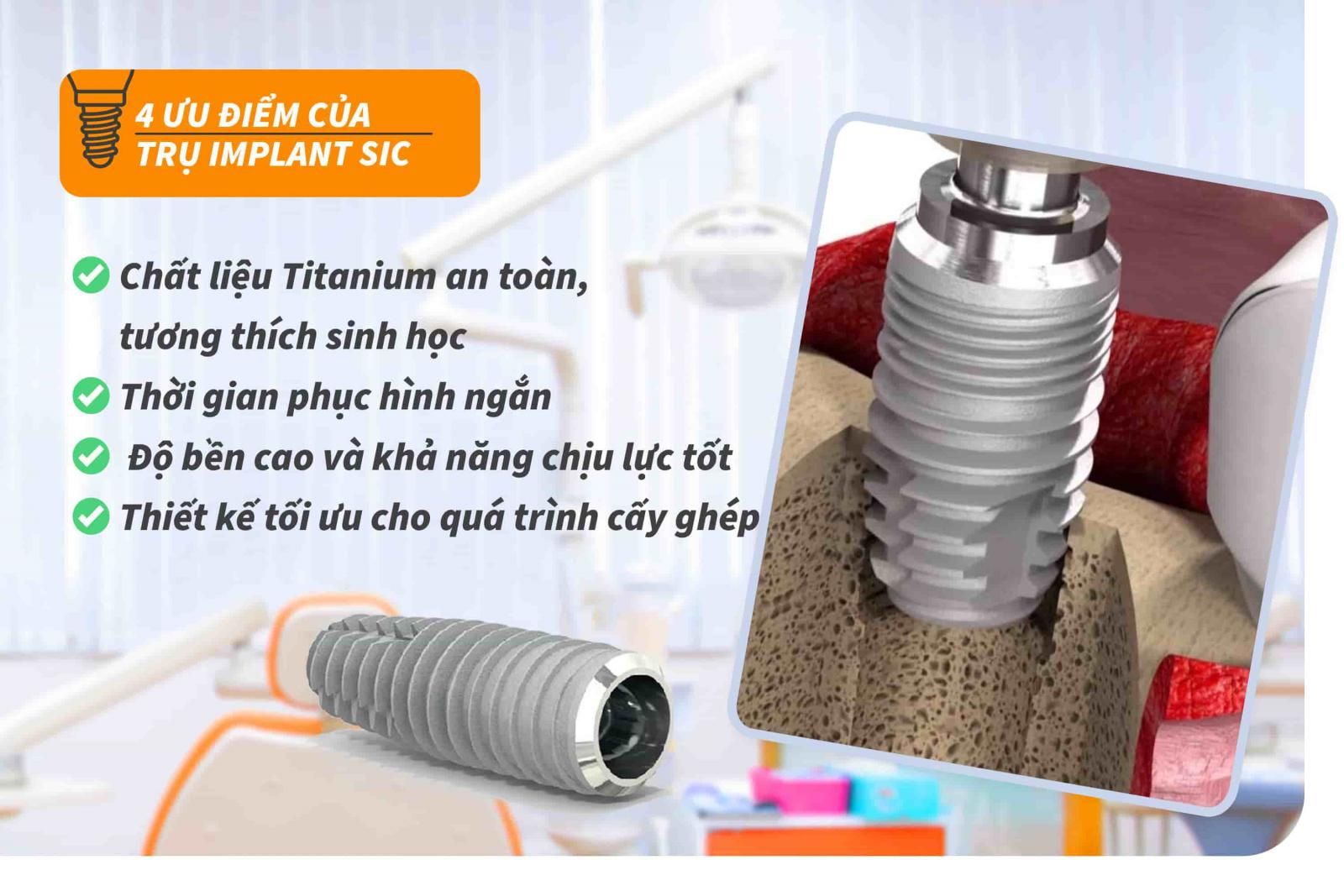 4 ưu điểm của trụ Implant SIC