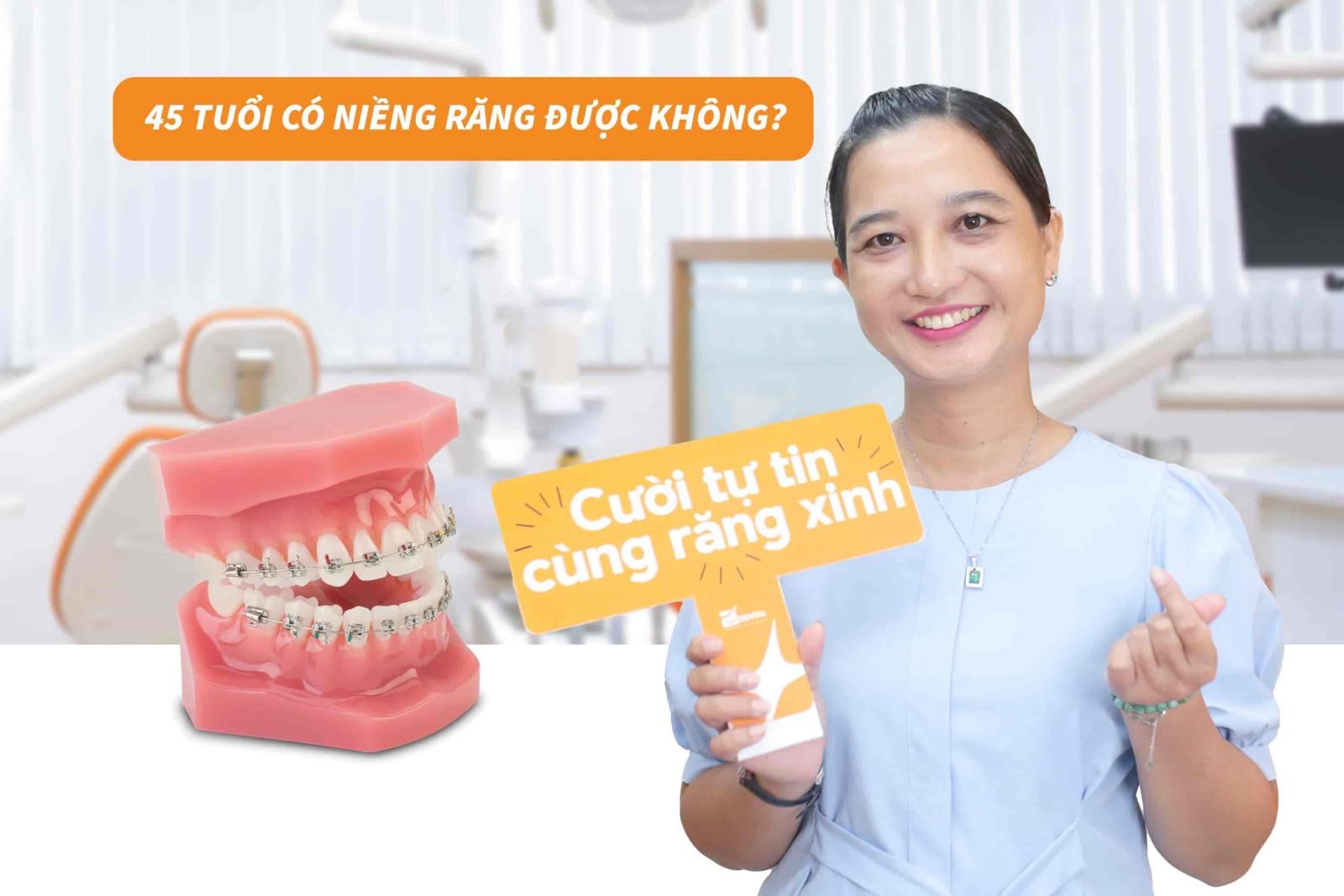 45 tuổi có niềng răng được không