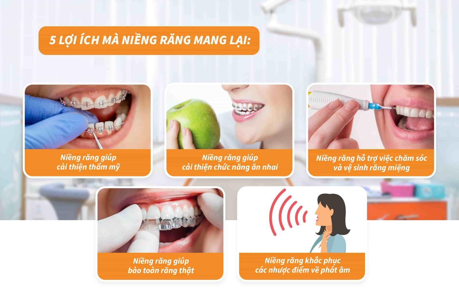 5 lợi ích mà niềng răng mang lại