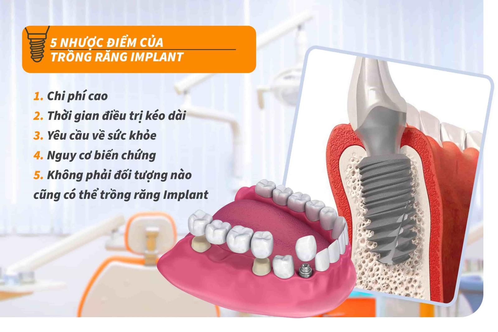 5 nhược điểm của trồng răng Implant