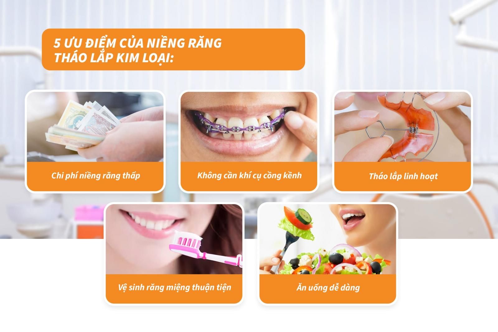 5 ưu điểm của niềng răng tháo lắp kim loại