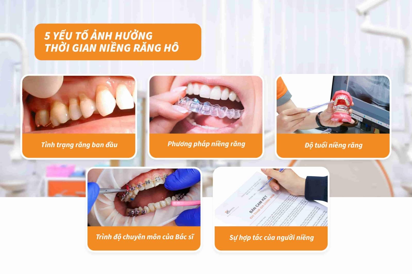 05 yếu tố ảnh hưởng thời gian niềng răng hô