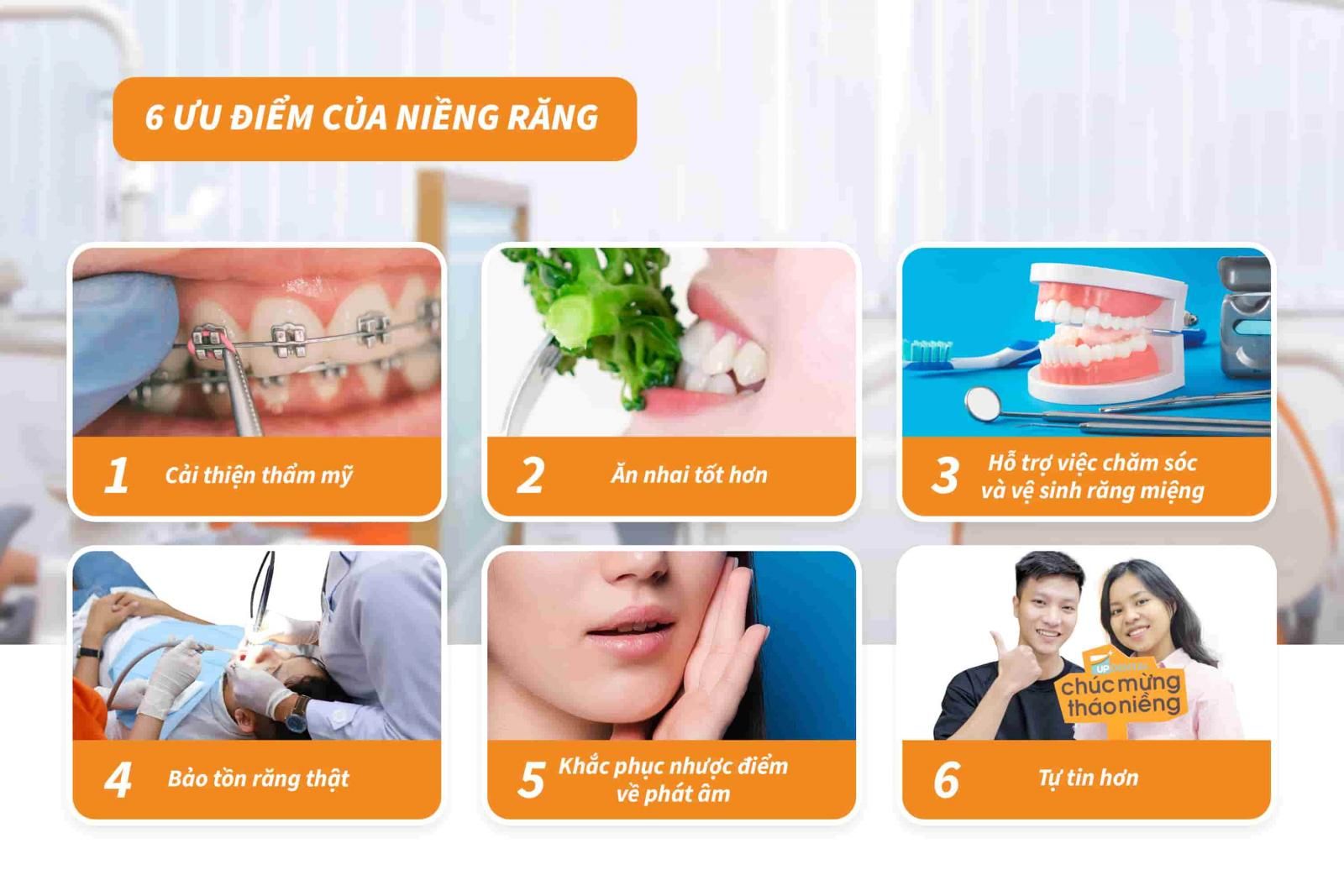 06 ưu điểm của niềng răng