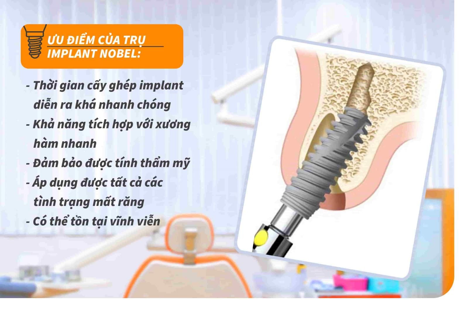 6-uu-diem-cua-tru-implant-nobel