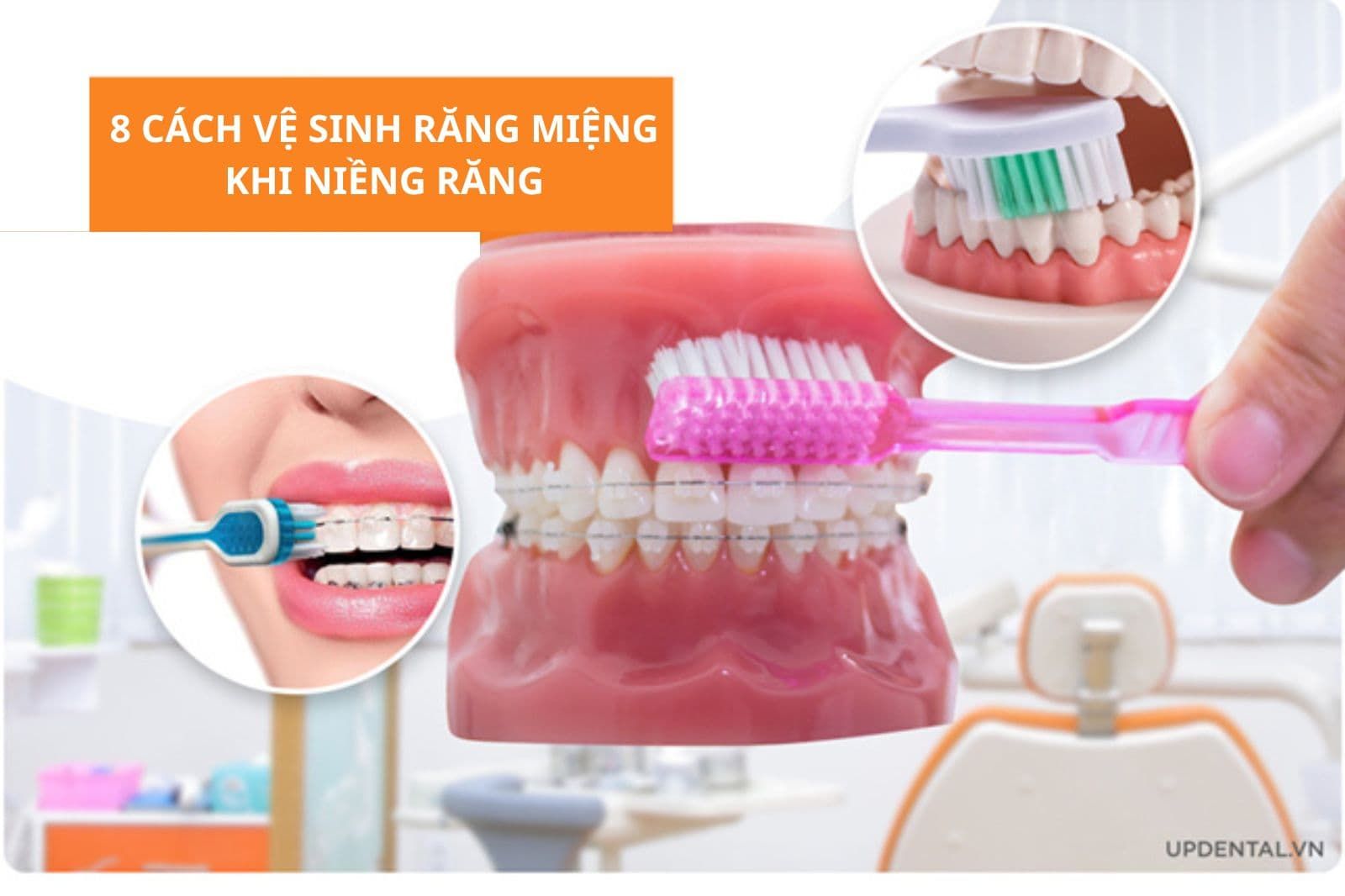 8 cách vệ sinh răng miệng khi niềng răng