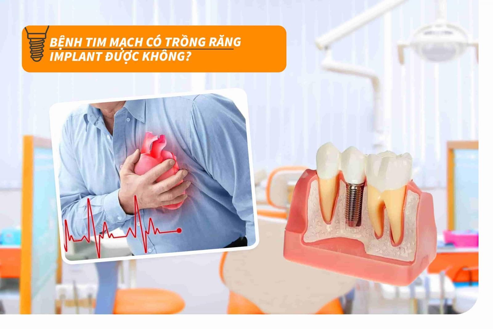 Bệnh tim mạch có trồng răng Implant được không? 