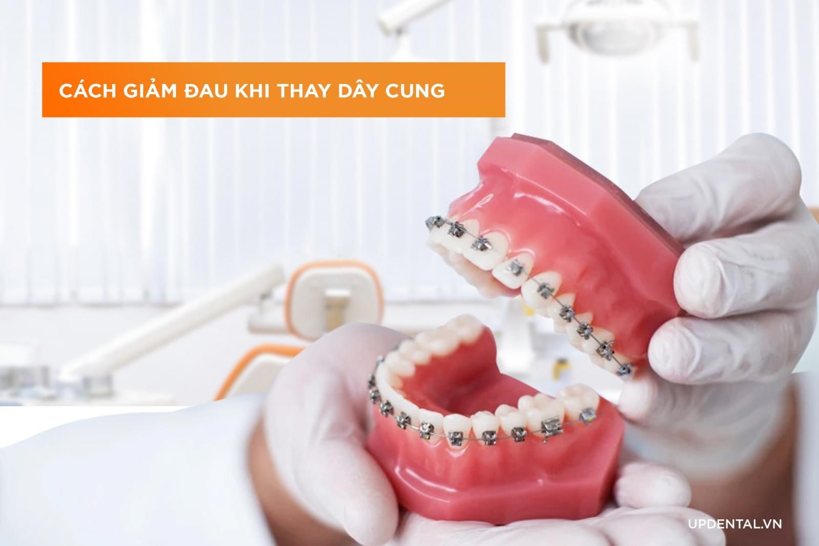 cách giảm đau khi thay dây cung