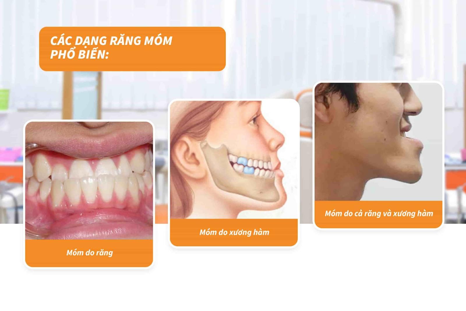 Các dạng móm phổ biến