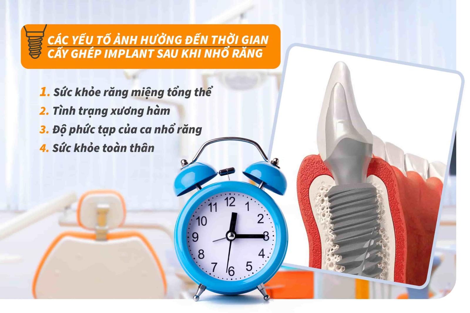 Các yếu tố ảnh hưởng đến thời gian cấy ghép Implant sau khi nhổ răng