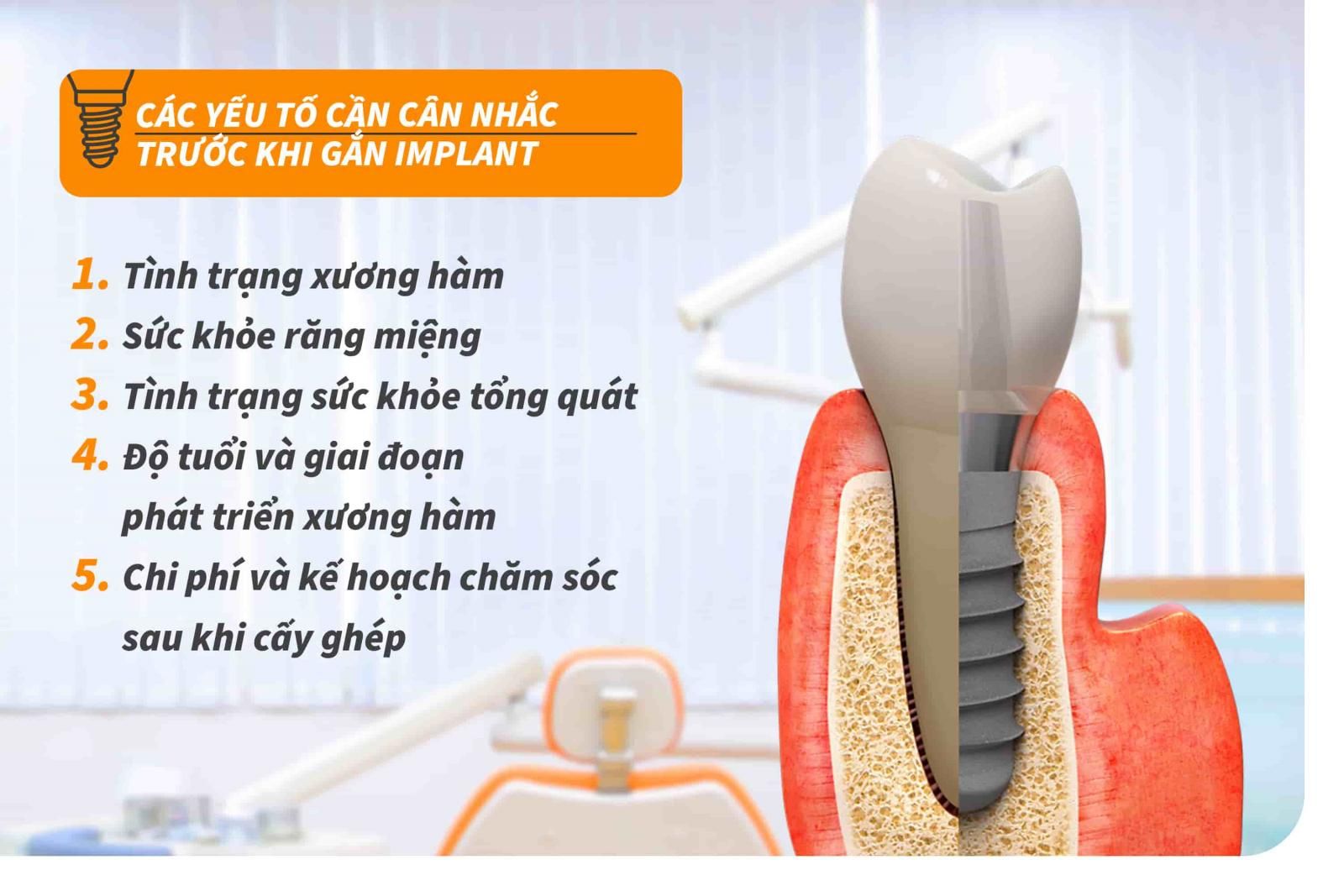 Các yếu tố cần cân nhắc trước khi gắn Implant