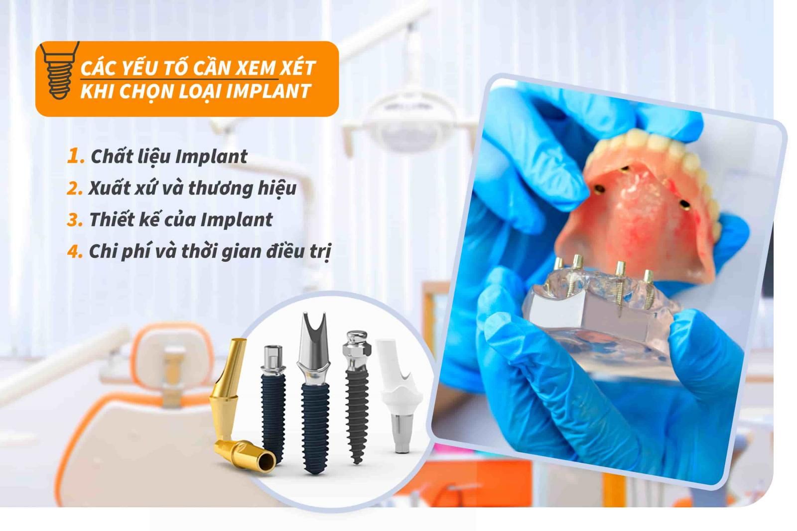 Các yếu tố cần xem xét khi chọn loại Implant