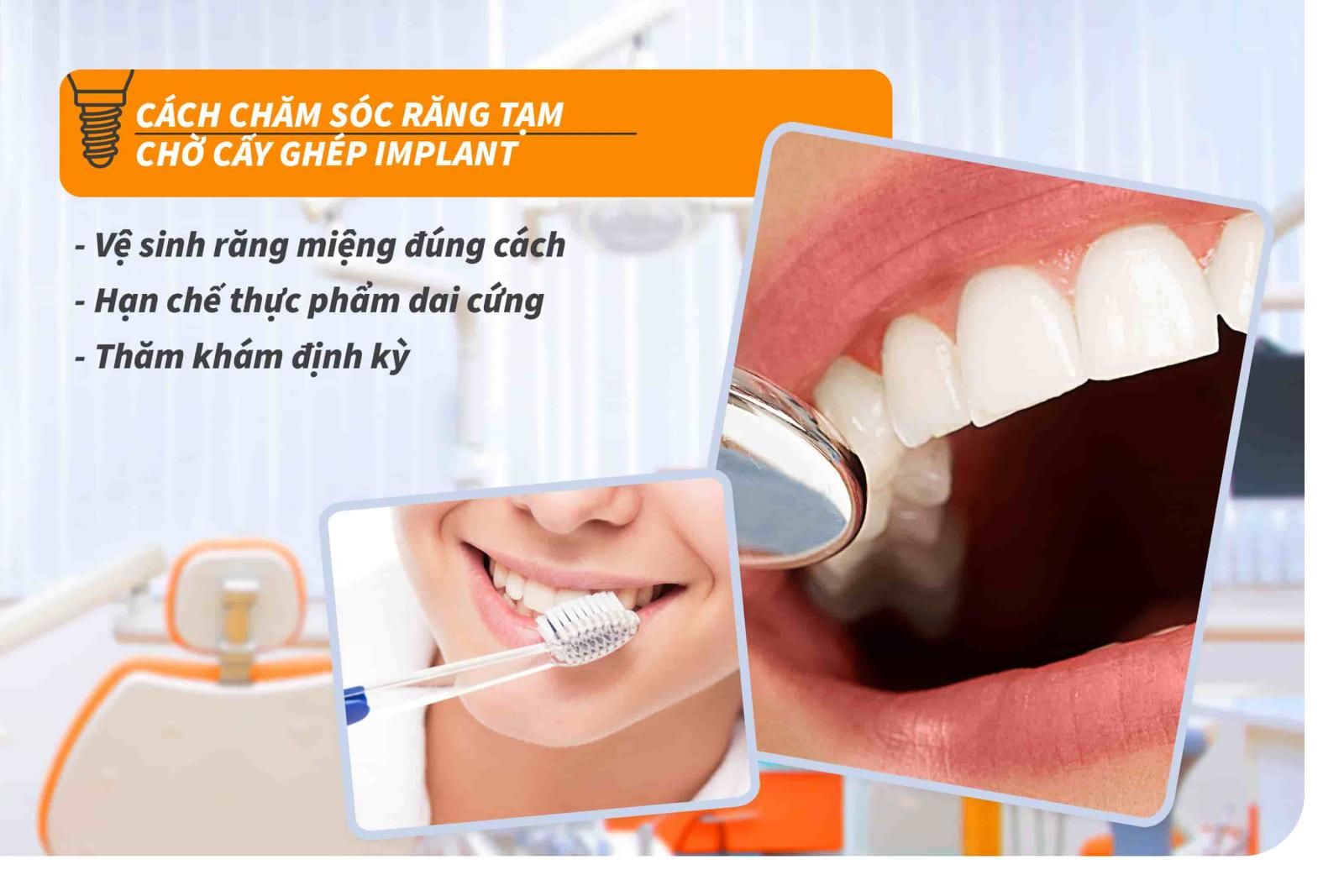 Cách chăm sóc răng tạm chờ cấy Implant