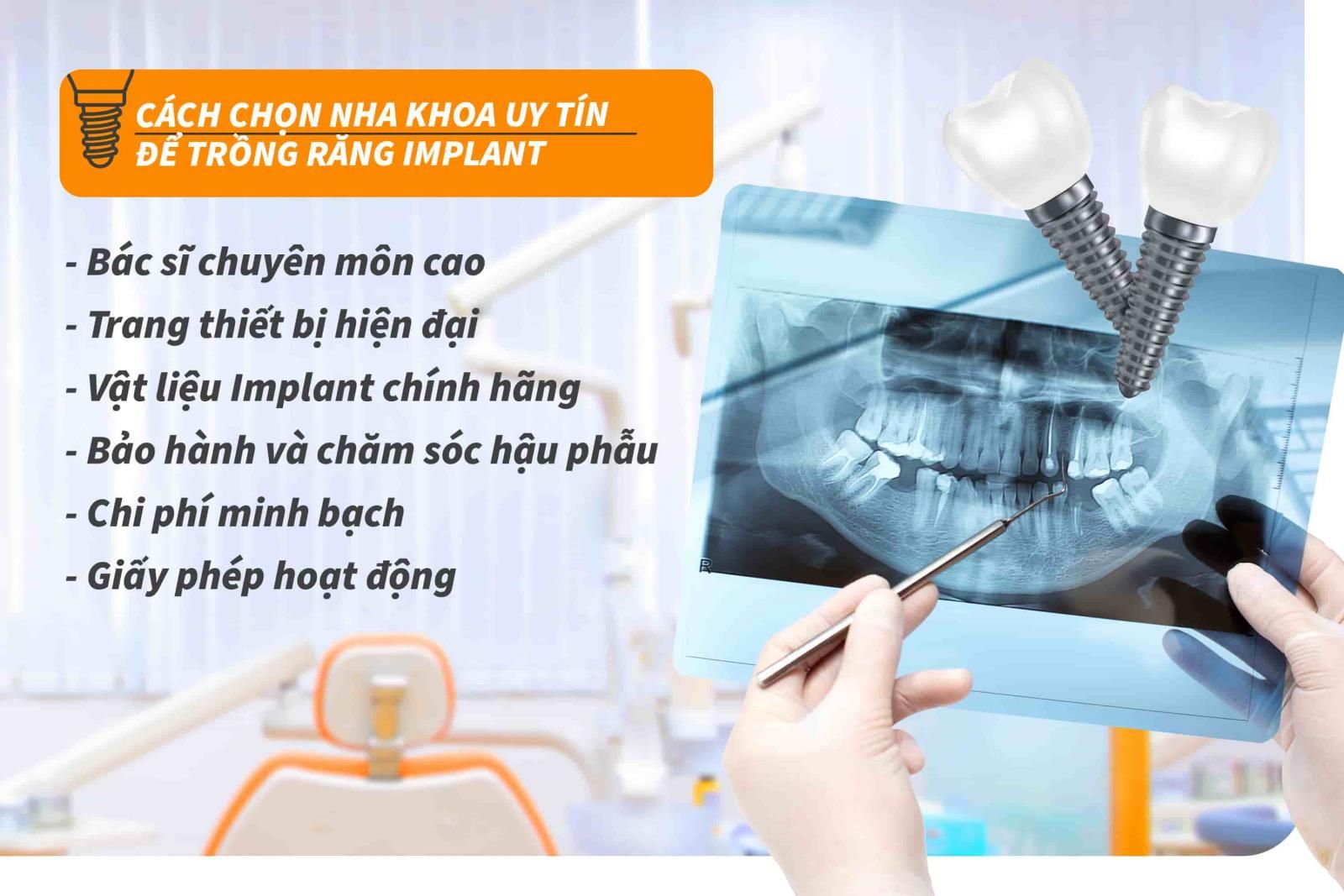 Cách chọn nha khoa uy tín để trồng răng Implant