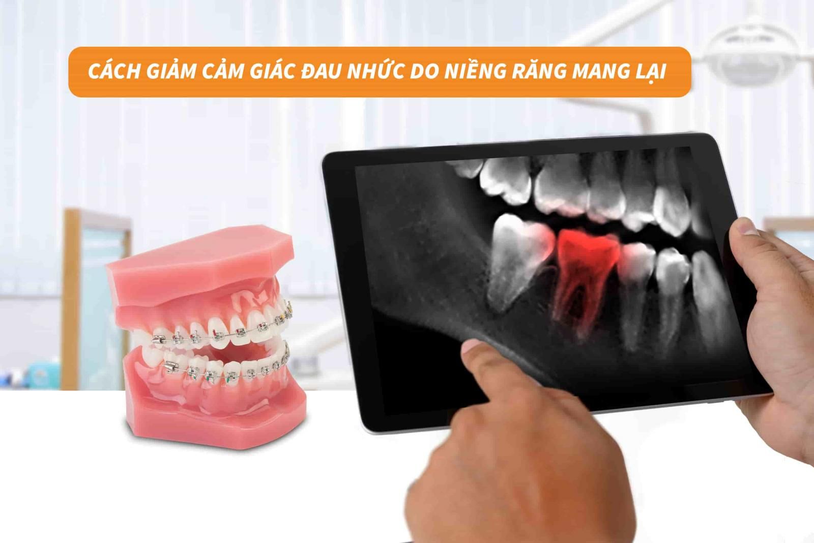 Cách giảm đau nhức do niềng răng mang lại