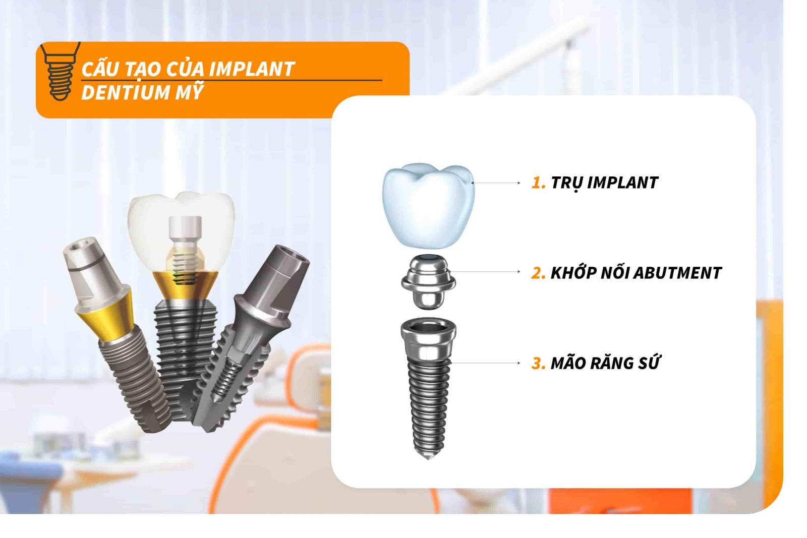 Cấu tạo của Implant Dentium Mỹ