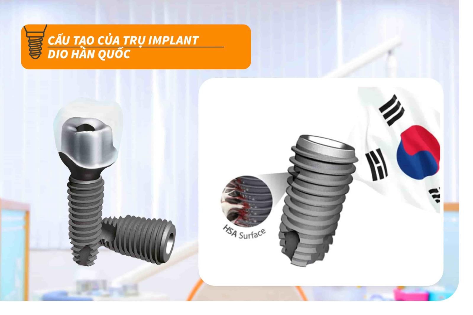 Cấu tạo của trụ Implant Dio Hàn Quốc