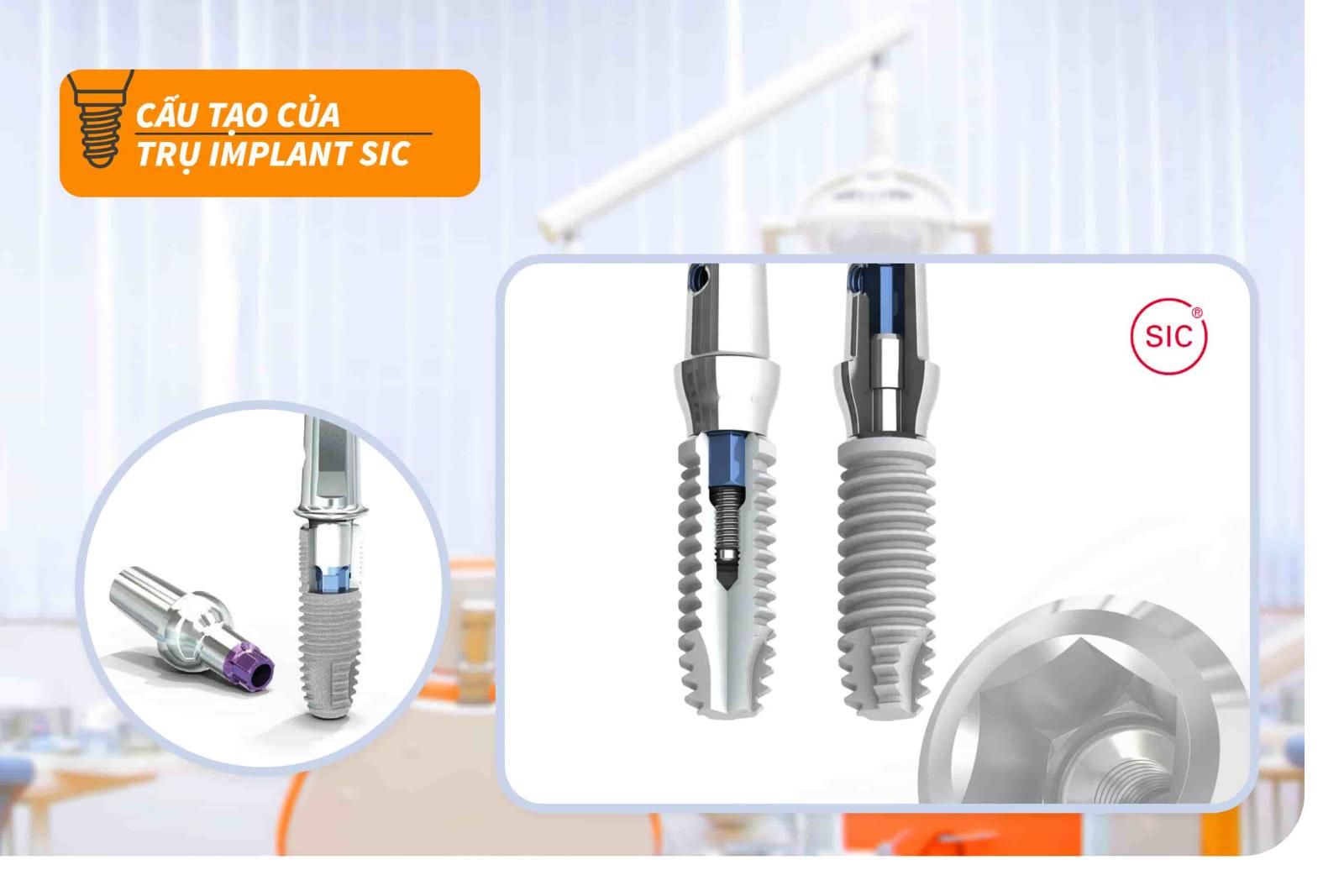 Cấu tạo của trụ Implant SIC