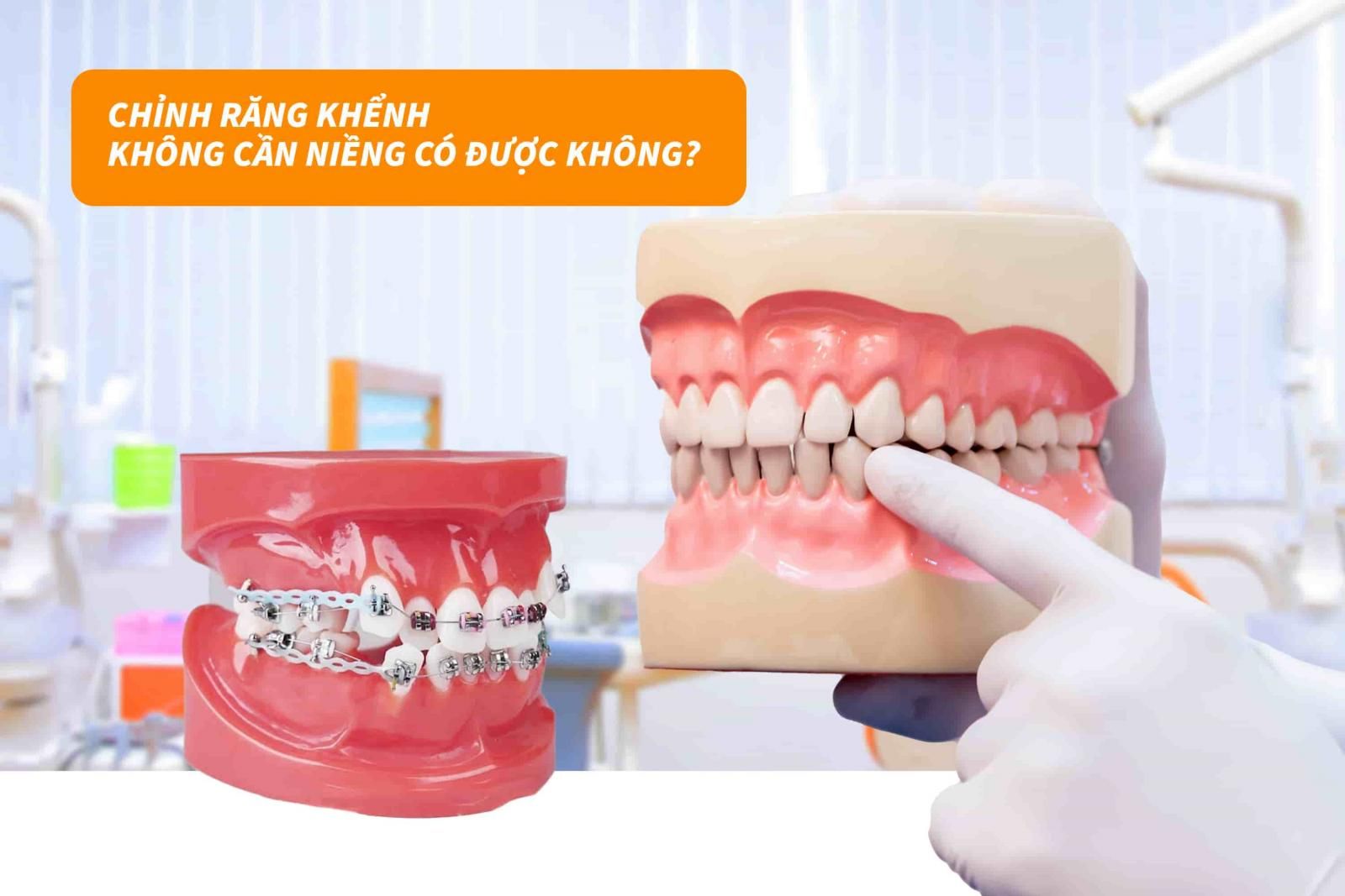 Chỉnh răng khểnh không cần niềng có được không?