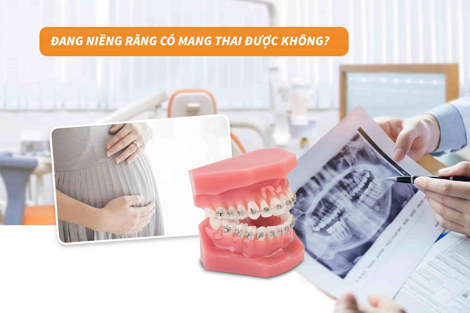 Đang niềng răng có mang thai được không?