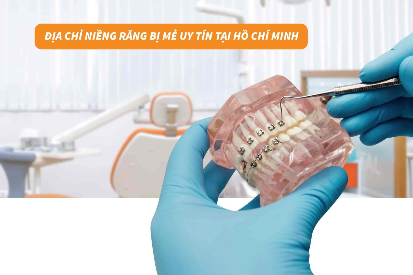 Địa chỉ niềng răng bị mẻ uy tín tại Hồ Chí Minh