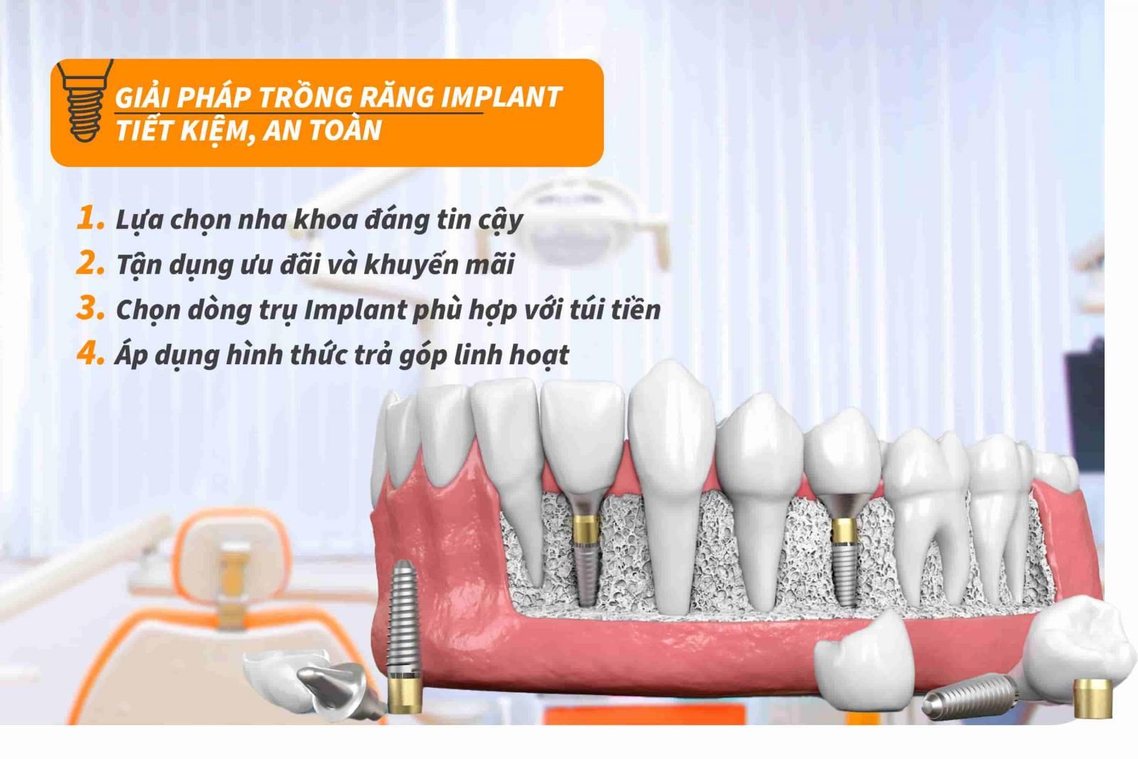 Giải pháp trồng răng Implant tiết kiệm, an toàn